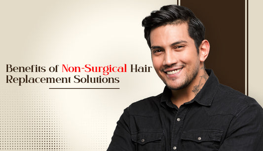 Benefits of Non-Surgical Hair Replacement Solutions