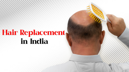 Everything you need to know about hair replacement in India