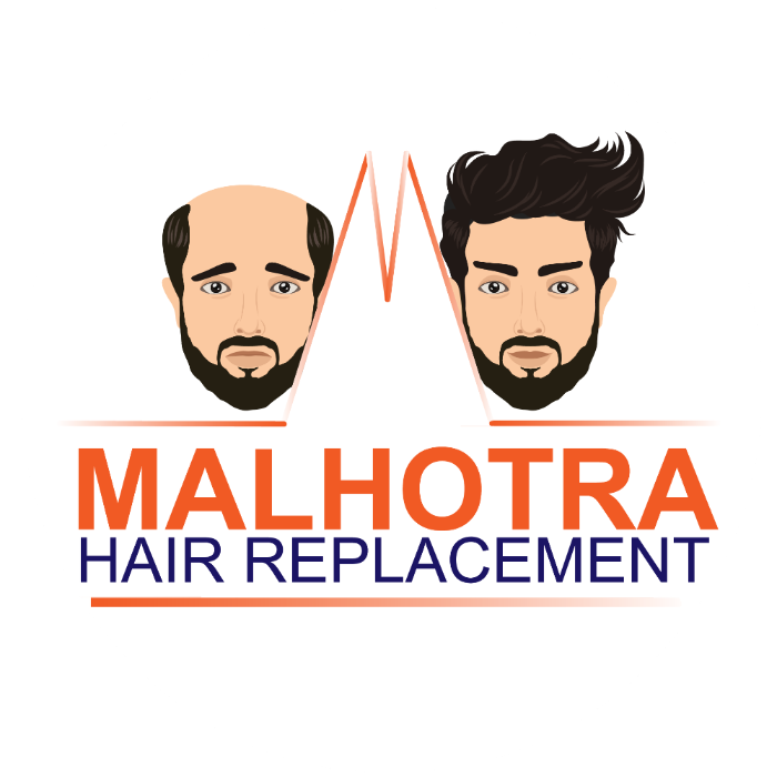 Malhotra Hair Replacement