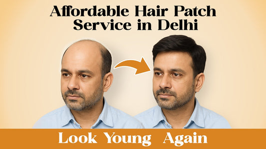 Affordable Hair Patch Service in Delhi – Look Young Again