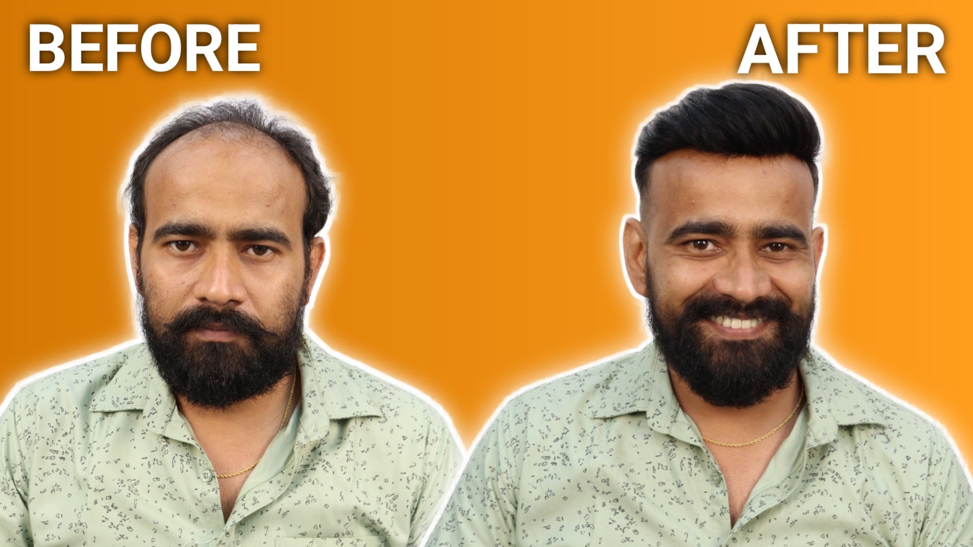 Hair Patch In Bhubaneswar