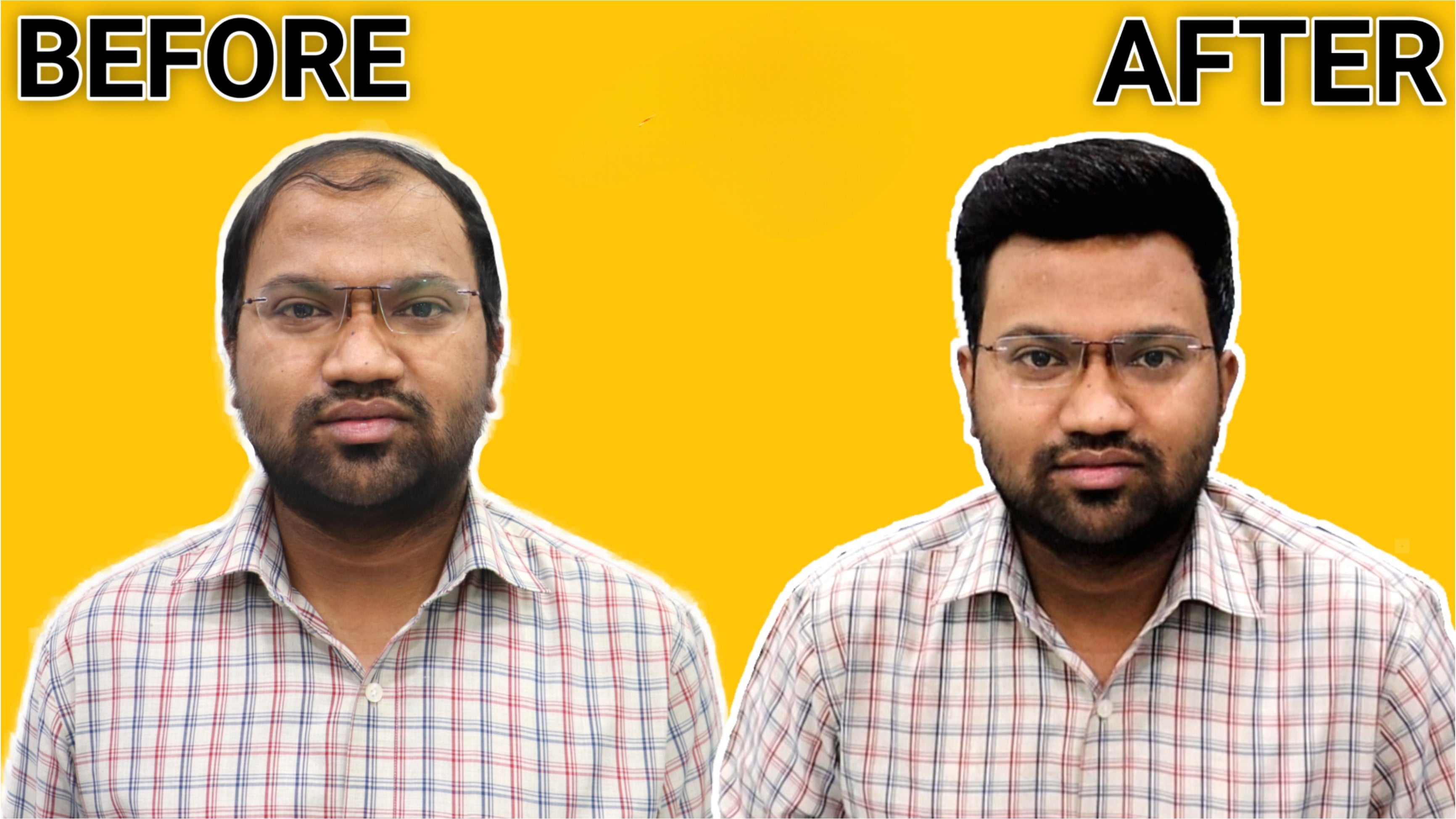 Delhi Hair Fixing  Ower  Delhi Hair Fixing  LinkedIn