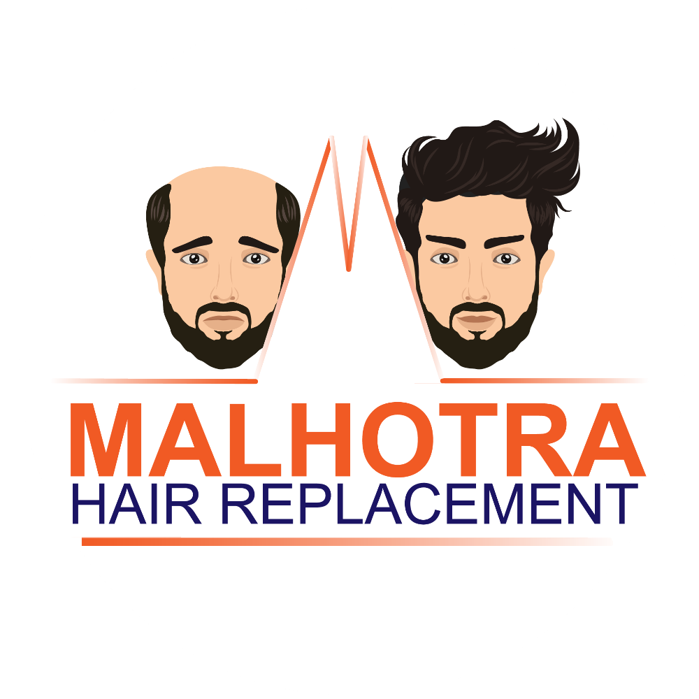 Malhotra Hair Replacement
